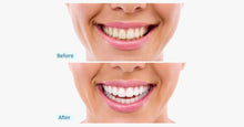 Load image into Gallery viewer, White Radiant Smile Home Kit - FREE SHIP DEALS