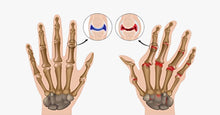 Load image into Gallery viewer, Arthritis Gloves - FREE SHIP DEALS