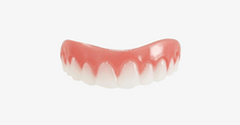 Load image into Gallery viewer, Comfort Fit Veneers - FREE SHIP DEALS